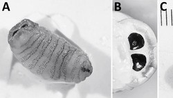 Larva Lalat Ditemukan di Hidung Wanita Setelah Mengalami Batuk Parah