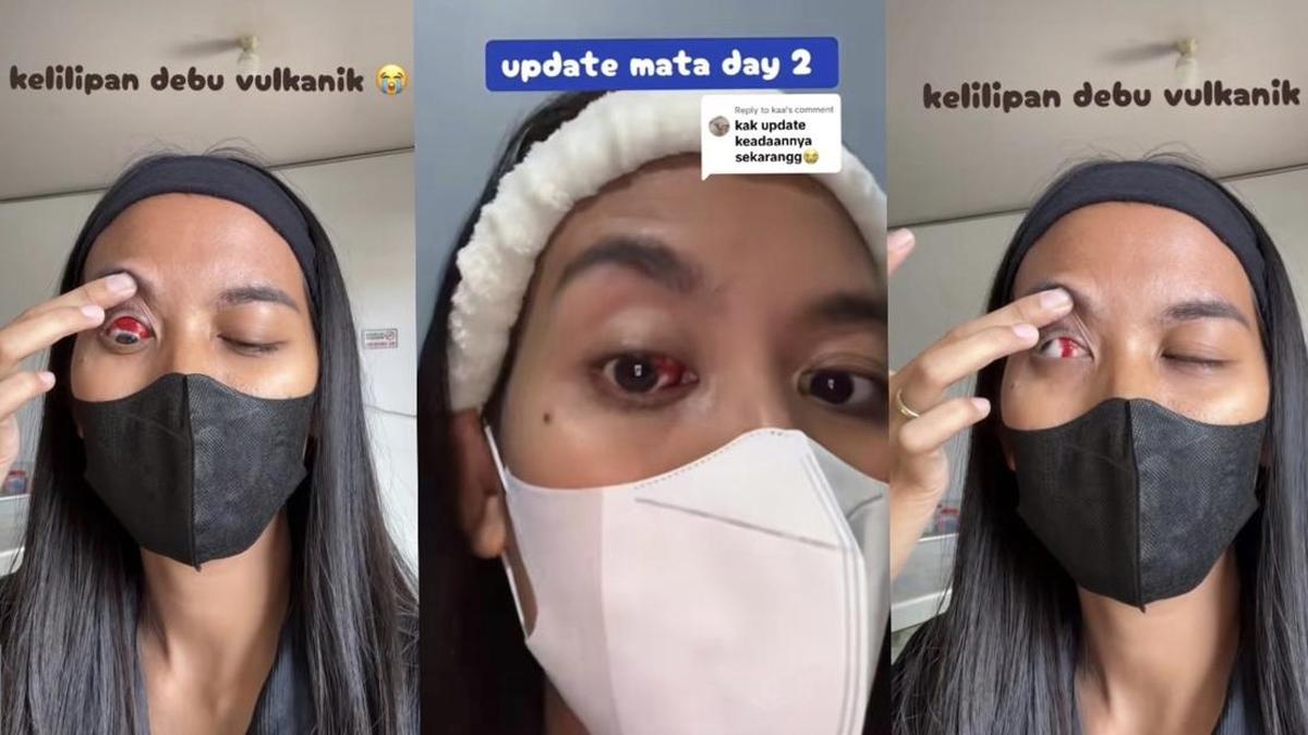 Foto: SS Viral TikTok