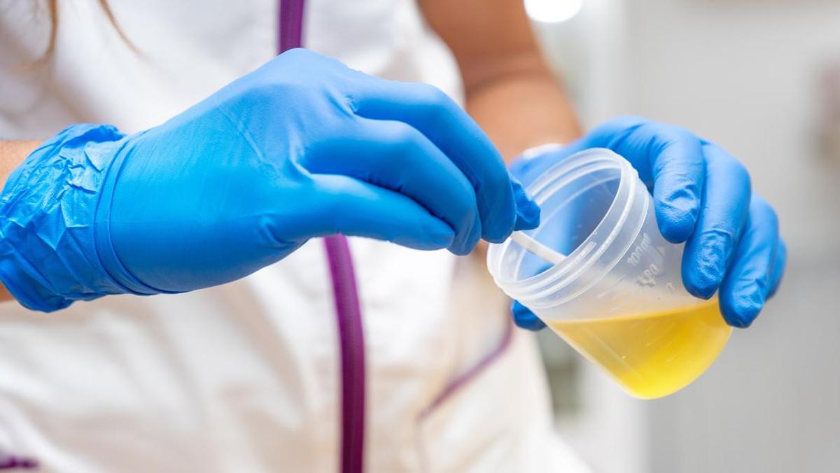 Pentingnya Memahami Warna Urine: Tidak Selalu Jernih Menandakan Kesehatan