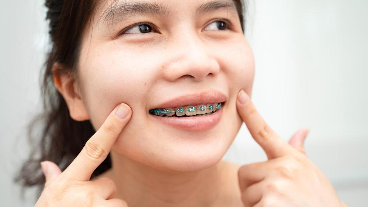 Pengguna behel sering mengalami momen iyup. Foto: Getty Images/sasirin pamai