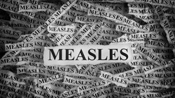 Kemenkes Tindak Tegas Konten Hoaks Terkait Campak dan Provokasi Antivaksin