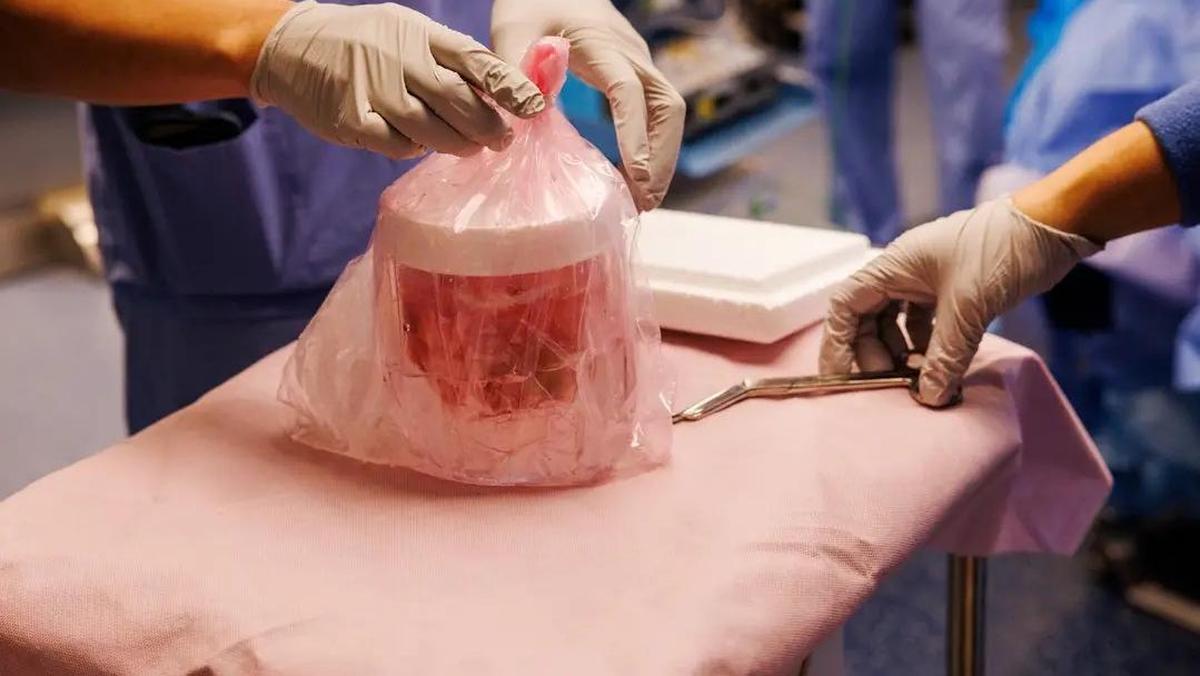 Pria di AS Bertahan Hidup 271 Hari dengan Ginjal Babi Sebelum Mendapat Donor Manusia