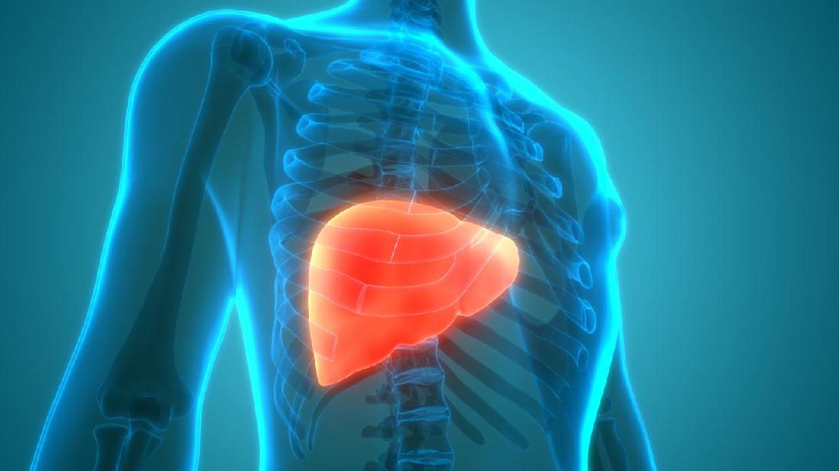 Kenaikan Kasus Fatty Liver di Usia 30-an, Gejala Sering Terlewatkan