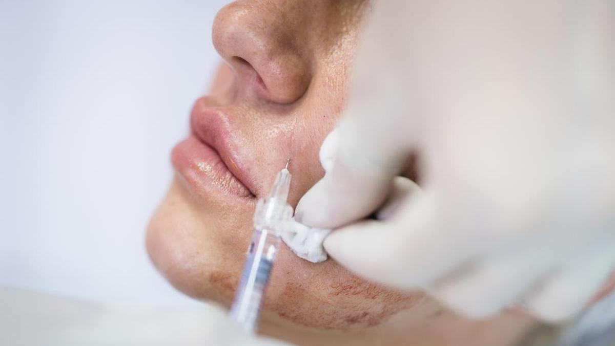 Perawatan Kulit Kontroversial: Skin Booster Kolagen dari Jaringan Kulit Manusia