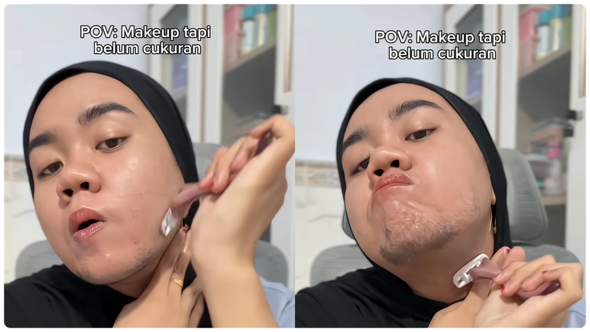 Viral Gadis 23 Tahun di Madura Mengalami Pertumbuhan Brewok Akibat Hirsutisme