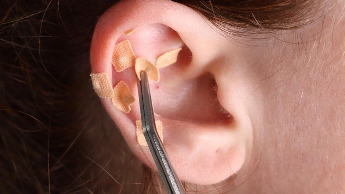 Tren Ear Seeds untuk Mengatasi Stres yang Populer di Kalangan Penggemar K-Pop