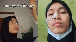 Viral, Wanita di Tasikmalaya Kehidupan Terganggu Karena Makanan Hanya Bisa Melalui Selang